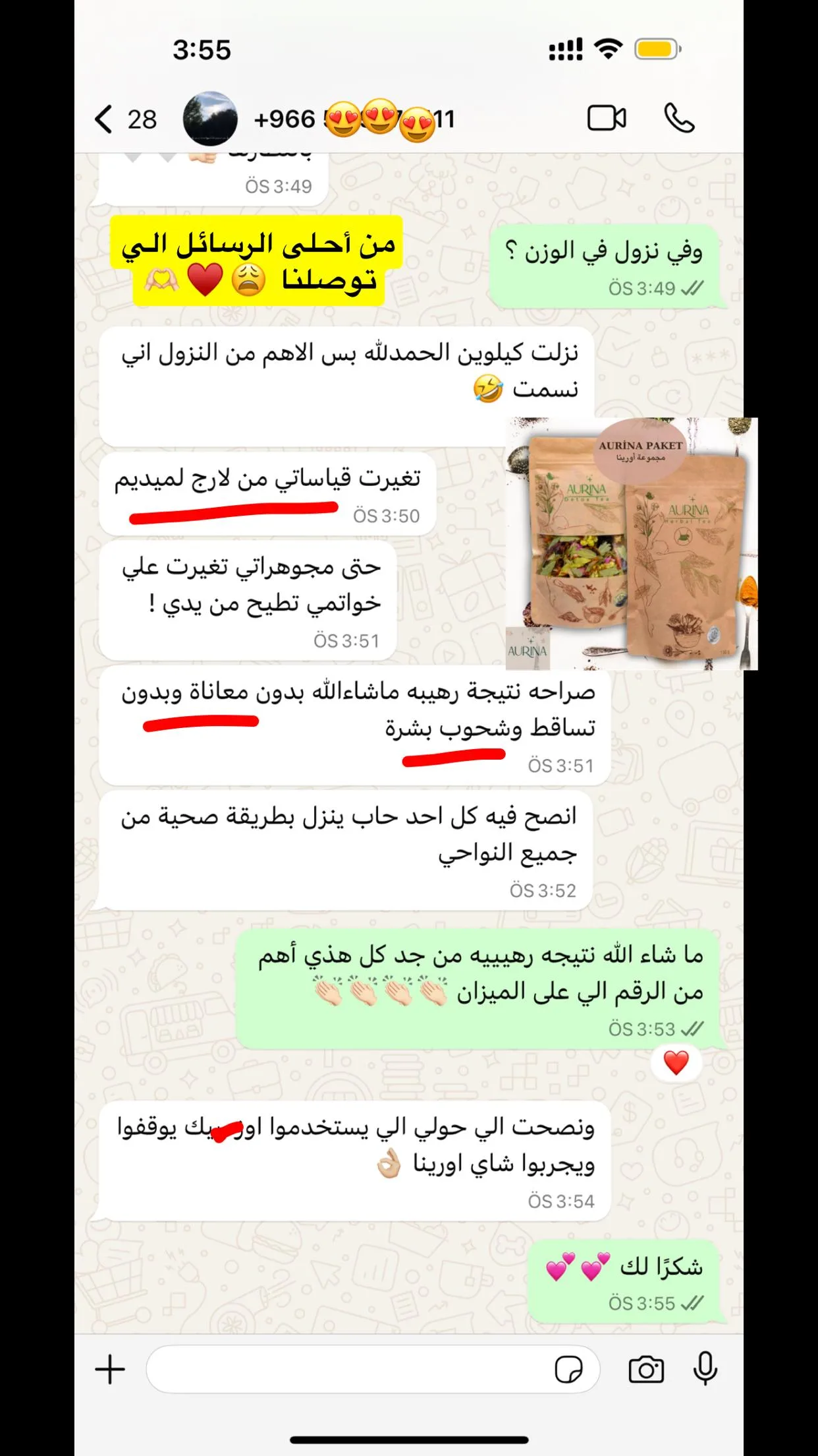 رأي عميلة أورينا رقم 34