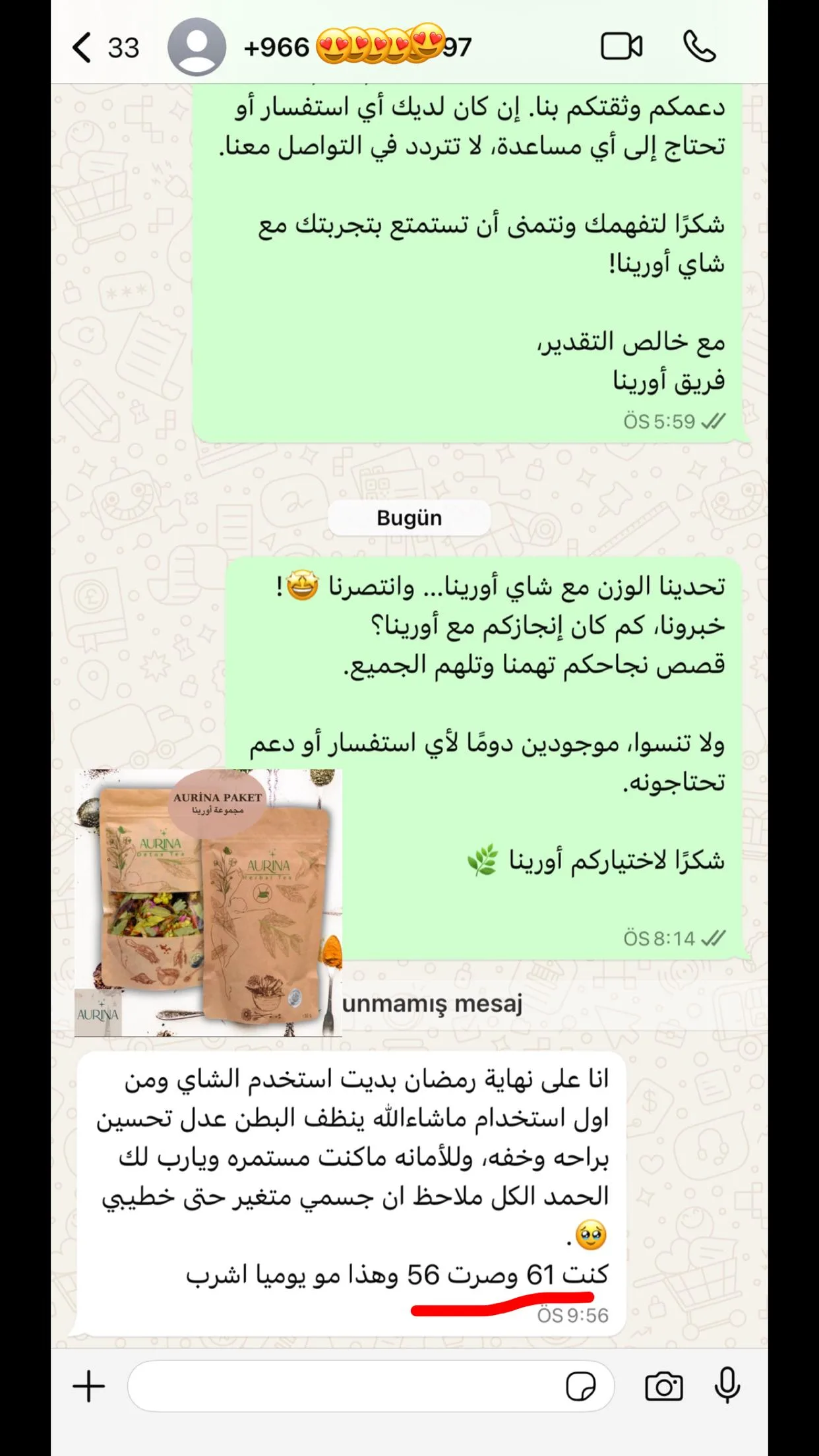 رأي عميلة أورينا رقم 47